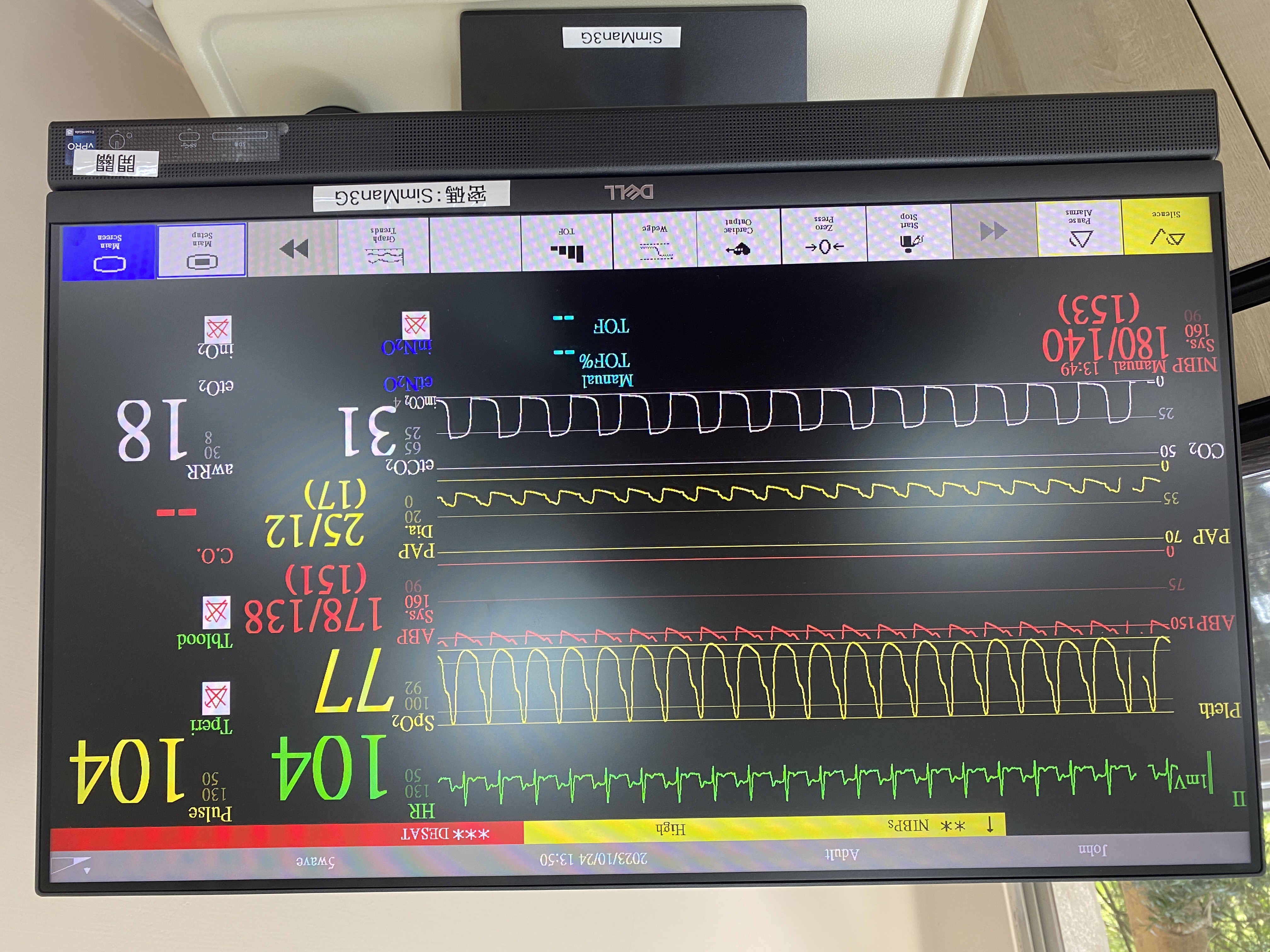 高階智能護理病人(Simman)